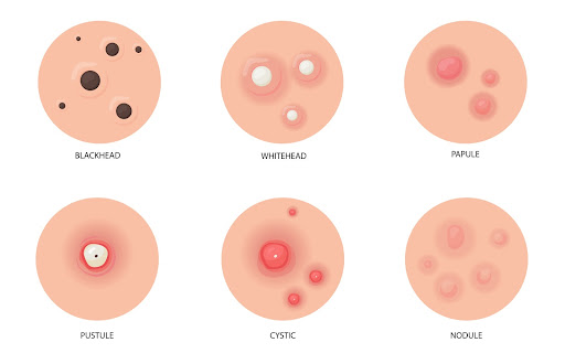 FF Kipas My ID: Verifikasi ID Gagal, Penyebabnya