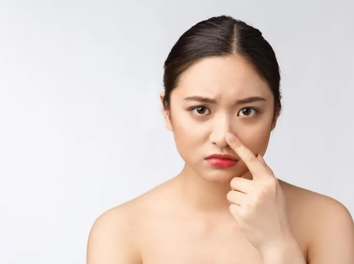 Jerawat di Hidung/ Foto: freepik.com/benzoix Jerawat di Hidung/ Foto: freepik.com/benzoix